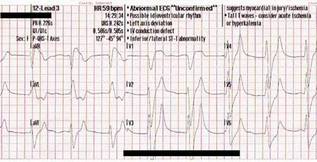 ECG Solution: What in the wide, wide world of sports?