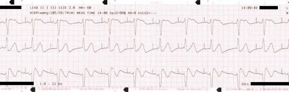 ECG Solution: The Right Stuff