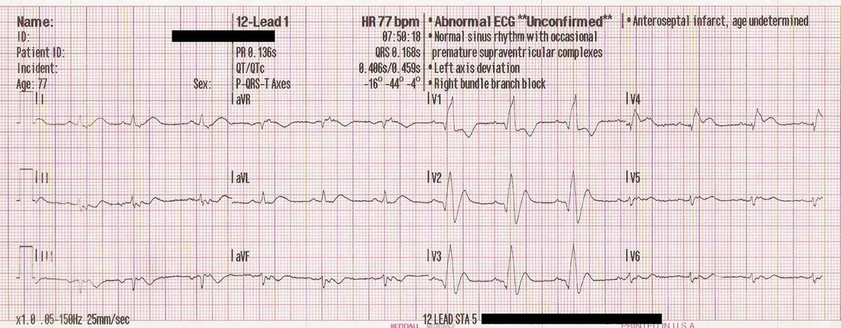 ECG Solution: The Right Stuff