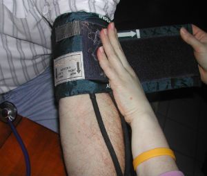 using too small blood pressure cuff