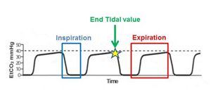 normal range of capnography