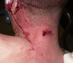 “I felt a weird sensation on the back of my neck,” said P.O. II John Timm. “Blood started to run down my neck and face and splatter onto the suspect.”