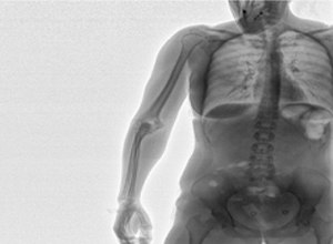 The Douglas County Sheriff's Department used the CONPASS DV to catch ingested medication.