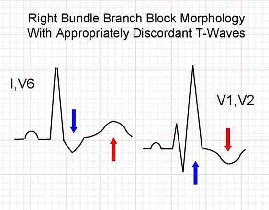 ECG Solution: The Right Stuff