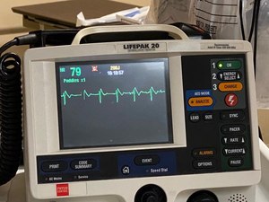 An ECG is vital in all patients who lose consciousness, and we must view young syncope ECGs through non-ischemia lenses and not just comment on ST elevation.
