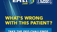 EKG case: Is a patient in shock because of hyperthermia 