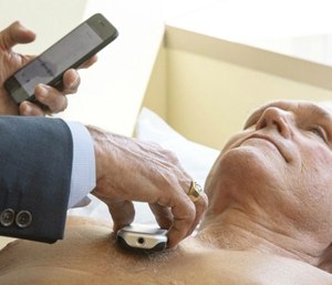 James Thomas, a cardiologist at Northwestern Hospital in Chicago examines Dennis Calling, a retired Chicago inspector, using Eko Duo, a new device for cardiovascular screening. (AP Photo/Amr Alfiky)
