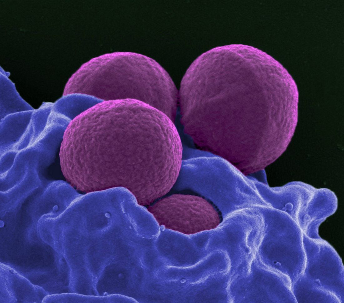 Controlling the spread of MRSA at your agency