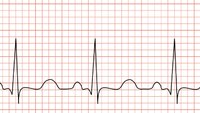 Medic Mindset Podcast: Thinking about tachycardia 
