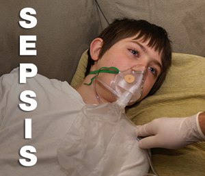 Sepsis is an over-reaction that is triggered by infection.