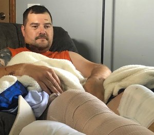Akron Police Officer Ryan Hughes talks about the crash that left him and three other officers injured.
