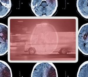 Researchers at Medical University of South Carolina (MUSC) Health found that in-ambulance telehealth consultations led to faster treatment times for stroke patients.