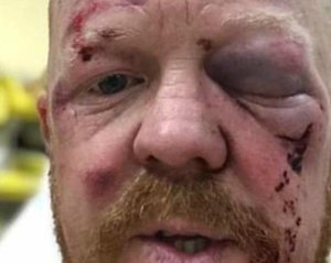 Daniel Mansbridge, a 16-year veteran paramedic, was seriously injured and must undergo eye surgery. (Photo/GoFundMe)