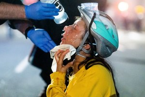 A medic treats Black Lives Matter protester Lacey Wambalaba after exposure to chemical irritants deployed by federal officers at the Mark O. Hatfield United States Courthouse on Friday, July 24, 2020, in Portland, Ore. Image: AP Photo/Noah Berger