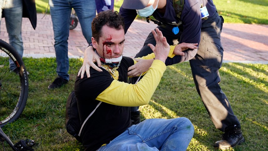 A counter-protester helps a supporter of President Donald Trump who was injured after he was attacked during a pro-Trump rally Saturday Nov. 14, 2020, in Washington.