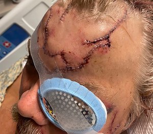 Allen Minish was mauled by a brown bear in a remote wooded area in Alaska on Tuesday. Rescuers carried Minish a quarter mile through swamps and brush to an ambulance after the attack.
