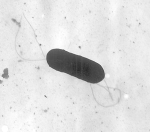 This 2002 electron microscope image made available by the Centers for Disease Control and Prevention shows a Listeria monocytogenes bacterium, which is responsible for the food borne illness listeriosis.
