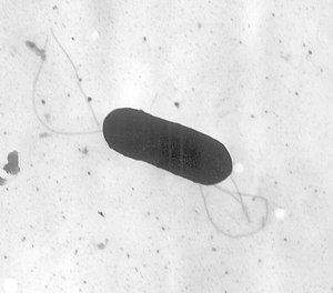 This 2002 electron microscope image made available by the Centers for Disease Control and Prevention shows a Listeria monocytogenes bacterium, which is responsible for the food borne illness listeriosis.
