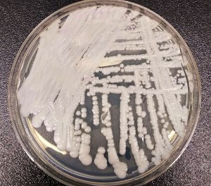 A strain of Candida auris cultured in a petri dish at a CDC laboratory.