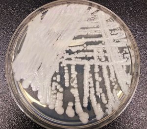 A strain of Candida auris cultured in a petri dish at a CDC laboratory.