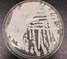 How Candida auris – a deadly drug-resistant fungus – presents in patients