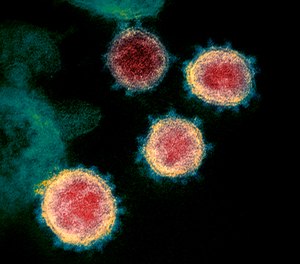 This undated electron microscope image made available by the U.S. National Institutes of Health in February 2020 shows the virus that causes COVID-19. Researchers from the University of Minnesota are conducting a trial to determine whether the medication hydroxychloroquine could help prevent or treat the disease.