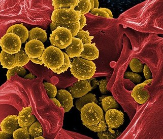 Quiz: How much do you know about sepsis?