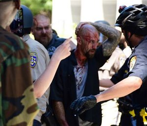 Police escort a wounded man away from in front of the Capitol in Sacramento, Sunday, after members of right-wing extremists groups holding a rally outside the California state Capitol building clashed with counter-protesters. (AP Photo/Steven Styles)