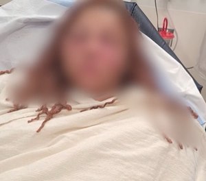 Swelling to Chrissy Nieto's face can be seen in this blurred photo taken in the hospital.