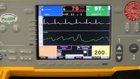 5 ways you’re not getting everything out of your cardiac monitor