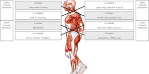 Janda's Muscle Imbalance Syndromes