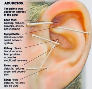Figure 1: Not only does Acudetox help reduce symptoms more rapidly, but deputies also report reduced misbehavior among inmates who receive the treatment.