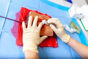 Discuss bleeding control with your crews and train providers both on how to physically control bleeding and how to incorporate the different hemostatic agents your agency has on hand.