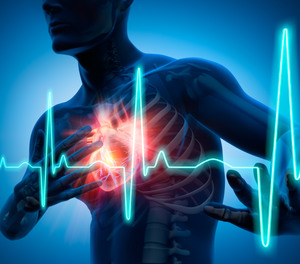 Commotio cordis is Latin for “agitation of the heart,” and occurs as a result of a sharp blow to the chest during the heart’s relative refractory period, inducing a mechanical R-on-T phenomenon and resultant ventricular fibrillation (VF) arrest.