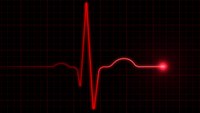 Medic Mindset Podcast: Thinking about bradycardia