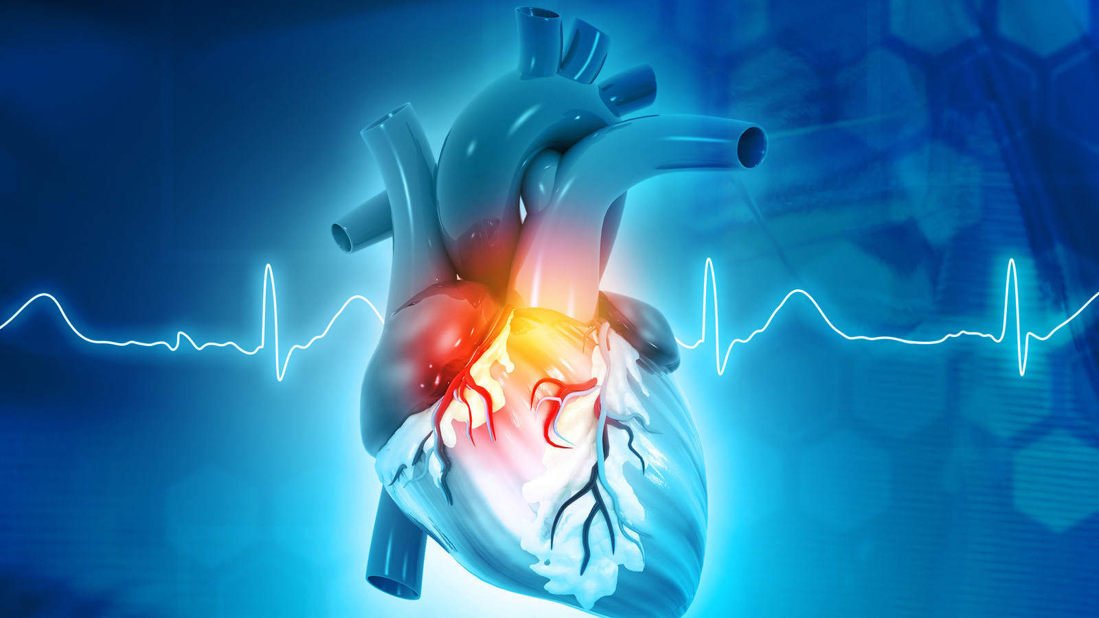 ECMO and eCPR in EMS refractory vfib management