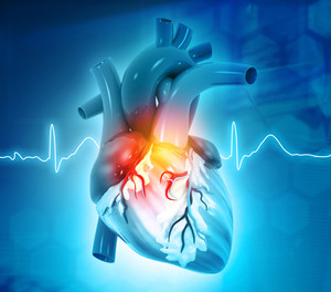 This study occurred from August 2019 through June 2020 at The University of Minnesota and included three transporting EMS systems.