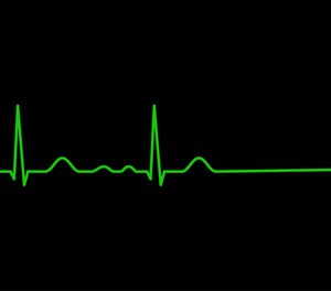 I broke into a sprint to my car. This had just become a real emergency, one of those 1% calls and patients you see that are time-sensitive, critical patients that you can actually help.