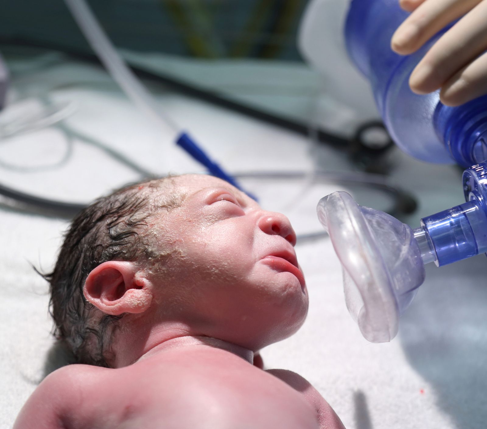 EMS training: Neonatal resuscitation