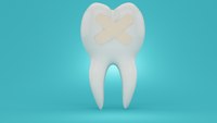 Dental emergencies: Prehospital considerations