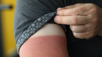 The threat is real: How firefighters can protect against skin cancer