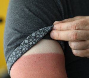 For those with lower levels of melanin, prolonged unprotected sun exposure causes skin cells in the epidermis (your skin’s surface) to become red, swollen and painful – aka sunburn.