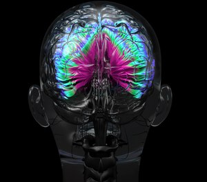 Delirium is often confused with dementia, which describes the chronic, progressive impairment that occurs over months to years.