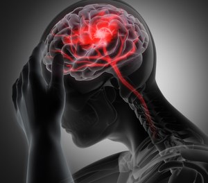 Traumatic brain injuries are classified by whether they involve the brain parenchyma or not.