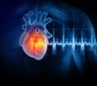 On-demand webinar: Heart disease in police: 90% of the clues we miss