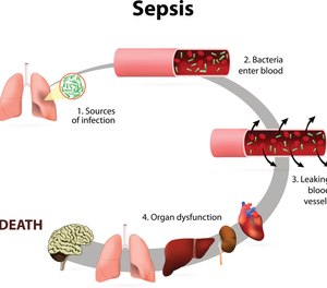 Worldwide, sepsis is a leading cause of morbidity, mortality and healthcare utilization for children.