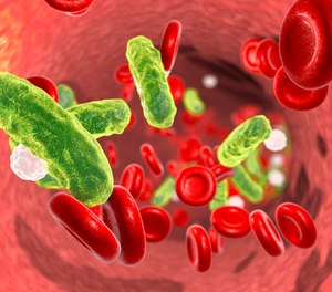 Early recognition is crucial to the recovery of the sepsis patient, and lactate plays an important role in the diagnosis of this killer.