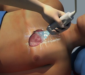 POCUS in the EMS setting can provide important internal clarity for assessing the heart, lungs and abdomen in trauma cases, as well as opportunities for vascular assessment and access.