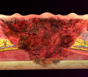 What is done for a patient with a burn injury in the first minutes can make a difference between a positive or a negative long-term outcome.