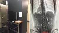 How one Oregon jail uses X-ray screening to keep out contraband drugs